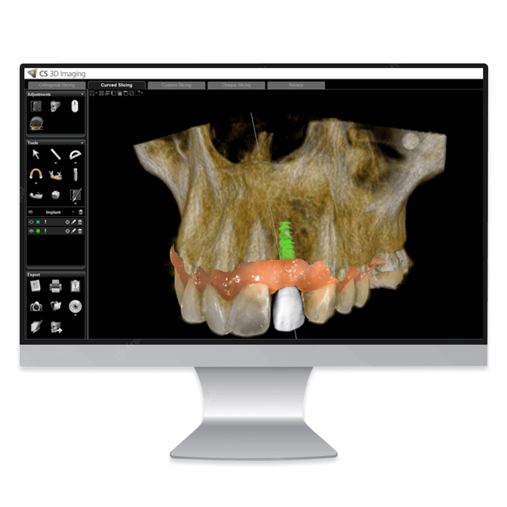 software CS 3D Imaging