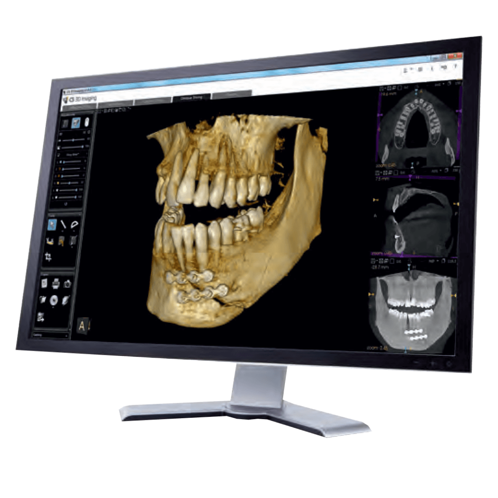 software CS 3D Imaging