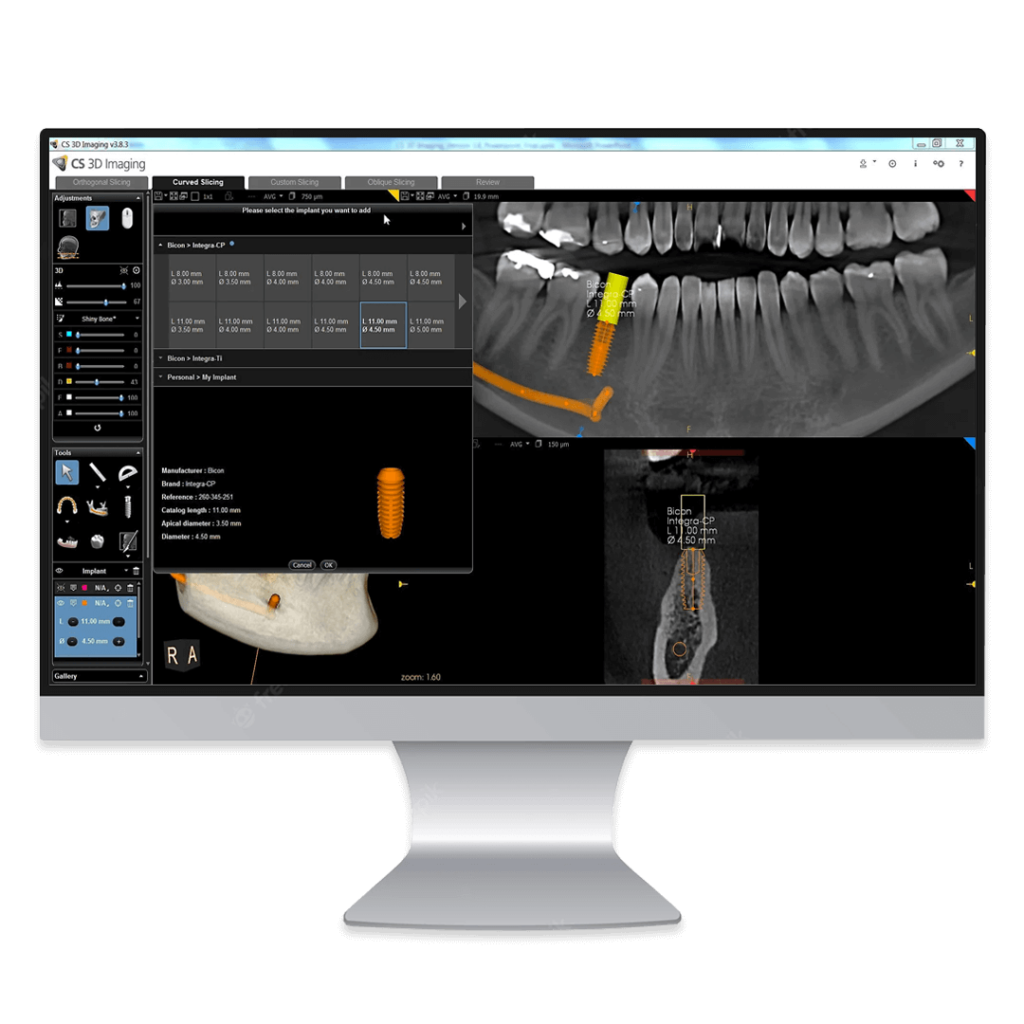 software CS 3D Imaging