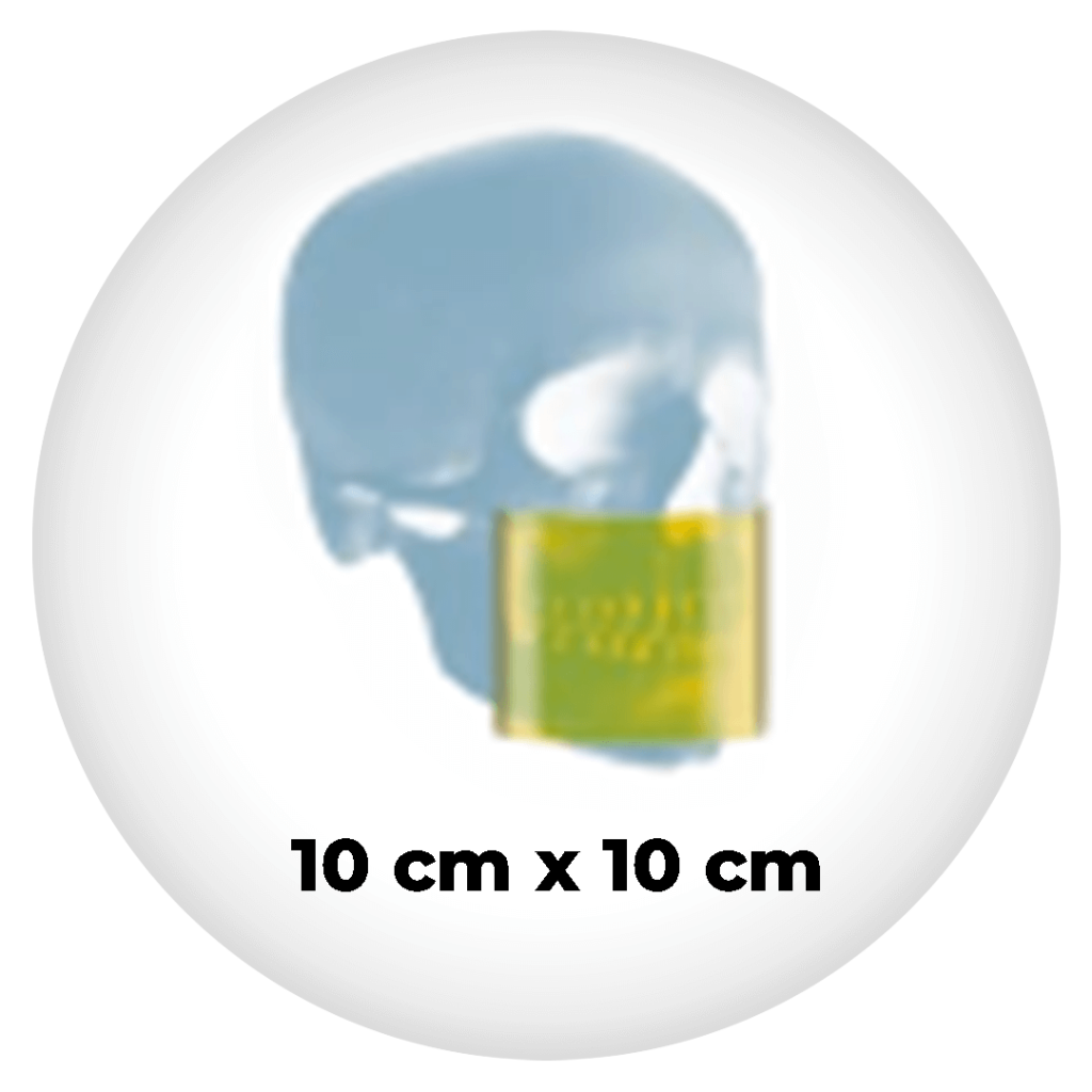 fov 10x10